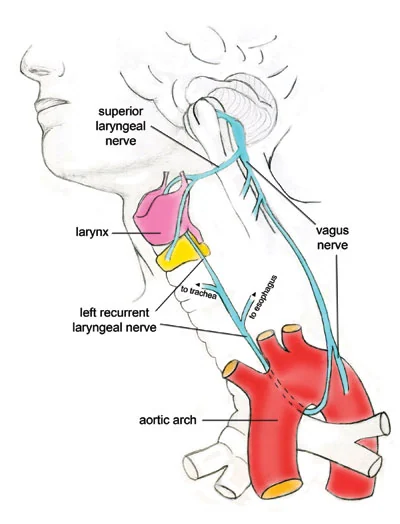 Does the recurrent laryngeal nerve refute intelligent design? Is it evidence that humans evolved from fish?